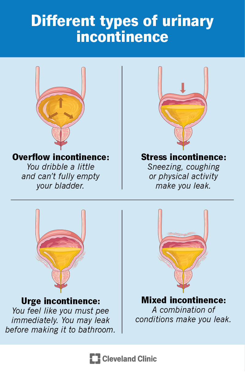 Unitary Incontinence Urinary Incontinence