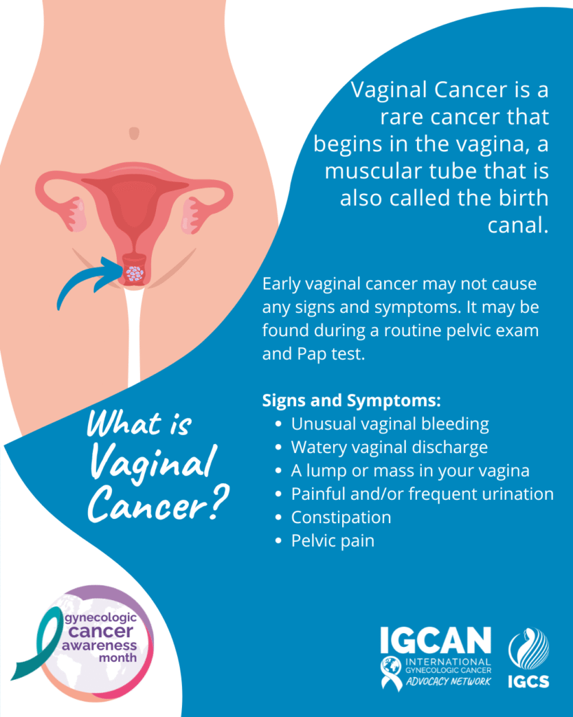 Vagina