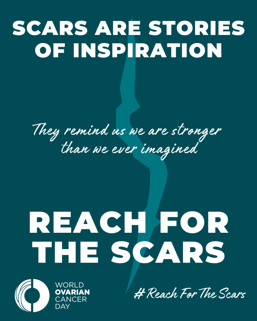 Ovarian Cancer